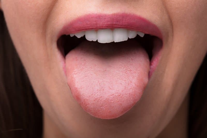 Mutual Constricted Boring Tipuri de boli si afectiuni ale limbii | Simptome, tratament, poze
