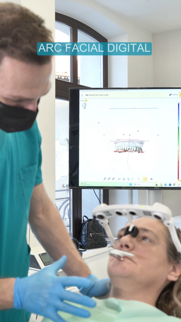 Arc facial digital