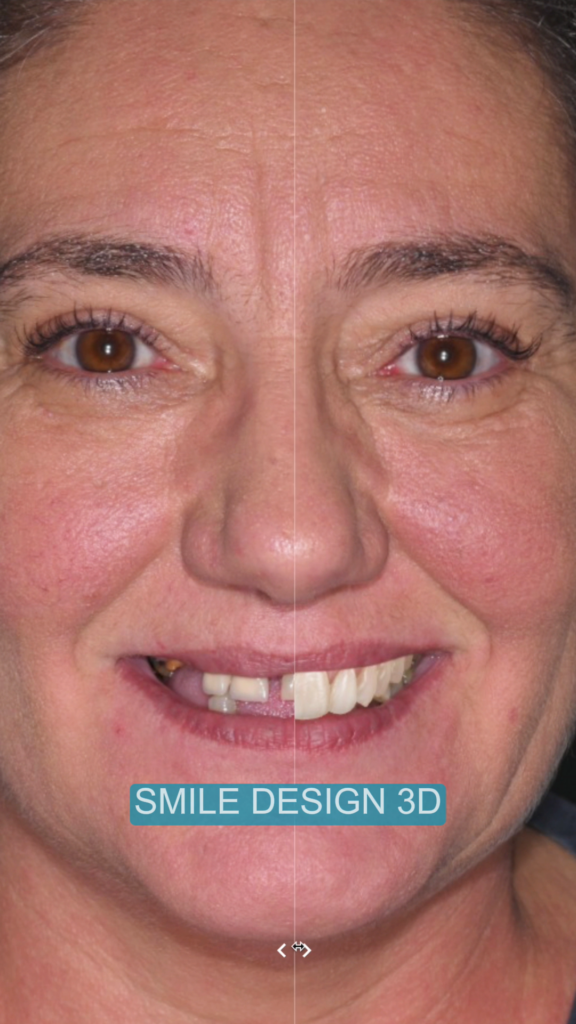 Digital Smile Design