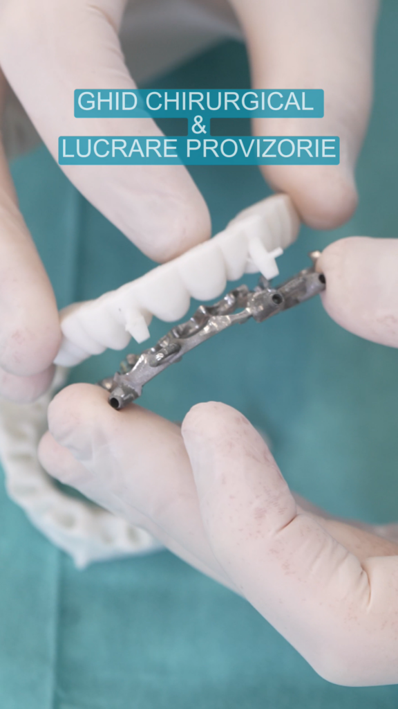 Ghid chirugical pentru implanturi si lucrare provizorie