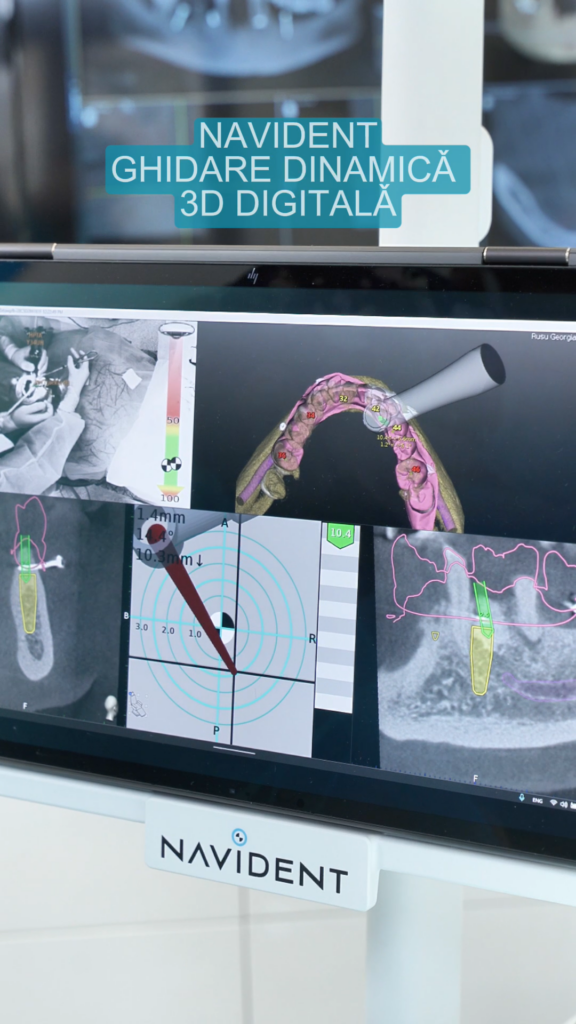 Ghidare digitala cu Navident