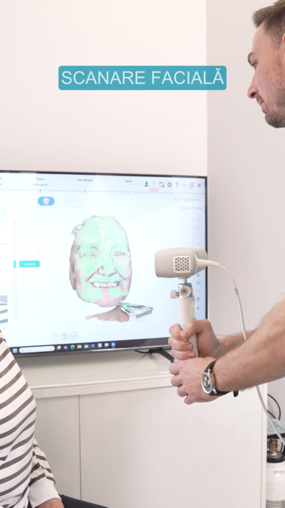 Scanare faciala digitala 3D