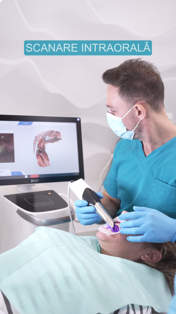 Scanare intraorala digitala
